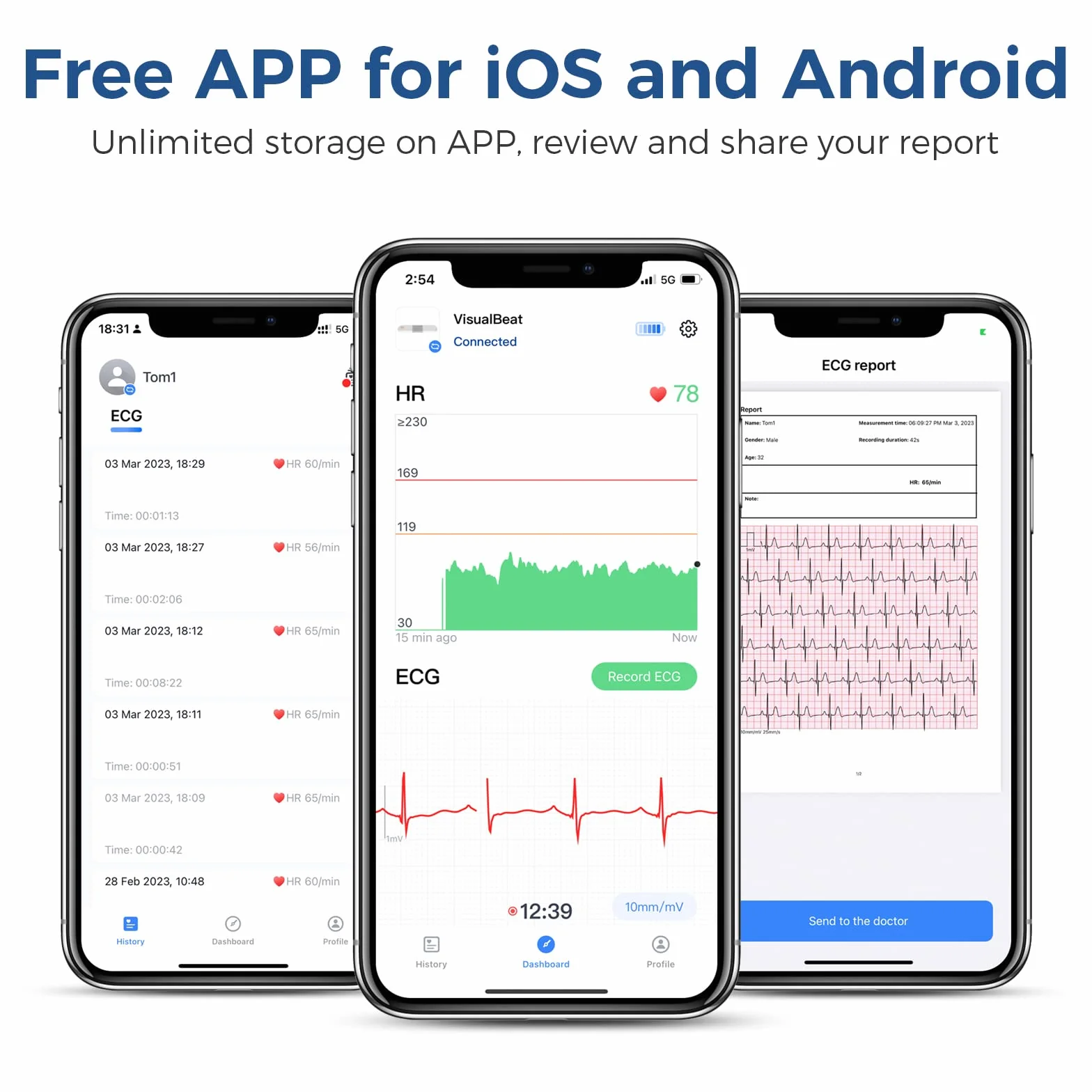 ViATOM Sensore di Frequenza Cardiaca, Cardiofrequenzimetro Cintura Toracica, Bluetooth ANT+, Monitor ECG con Cuscinetti per l'Esercizio Fisico, Indossabile senza Fili, con Allarme a Vibrazione