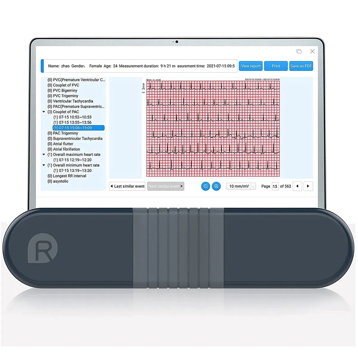 Wellue Monitor ECG, registratore Holter professionale con report di analisi AI-ECG, registrazione ECG 24 ore su 24, software di supporto per PC, stampa ECG PDF, cardiofrequenzimetro per uso domestico