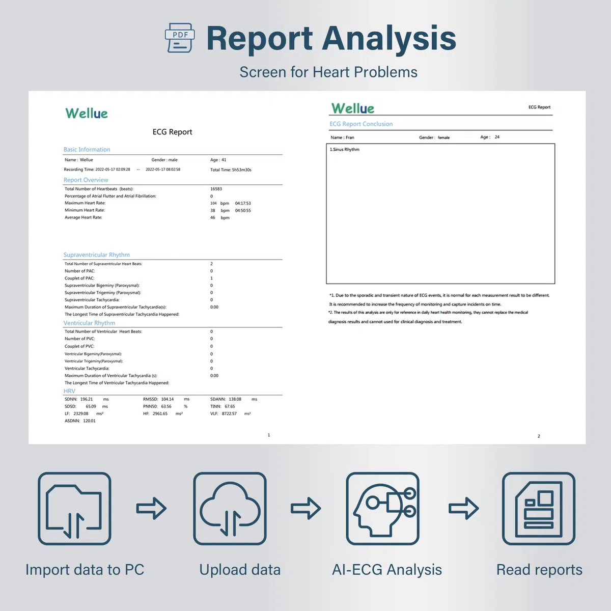 Wellue Monitor ECG, registratore Holter professionale con report di analisi AI-ECG, registrazione ECG 24 ore su 24, software di supporto per PC, stampa ECG PDF, cardiofrequenzimetro per uso domestico
