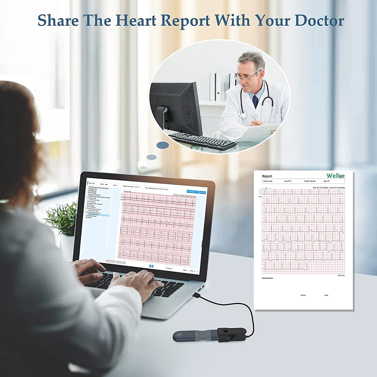 Wellue Monitor ECG, registratore Holter professionale con report di analisi AI-ECG, registrazione ECG 24 ore su 24, software di supporto per PC, stampa ECG PDF, cardiofrequenzimetro per uso domestico